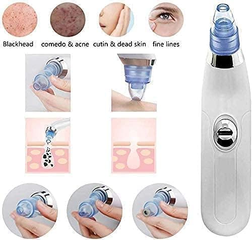 4 In 1 Multi-Function Blackhead Whitehead Extractor Remover Device Facial Cleansing Tool,Skin Cleaner,Pimple Removal Tool,Acne Pimple Pore Cleaner Vacuum Suction Tool For Men & Women