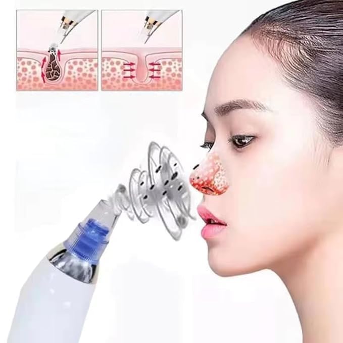 4 In 1 Multi-Function Blackhead Whitehead Extractor Remover Device Facial Cleansing Tool,Skin Cleaner,Pimple Removal Tool,Acne Pimple Pore Cleaner Vacuum Suction Tool For Men & Women