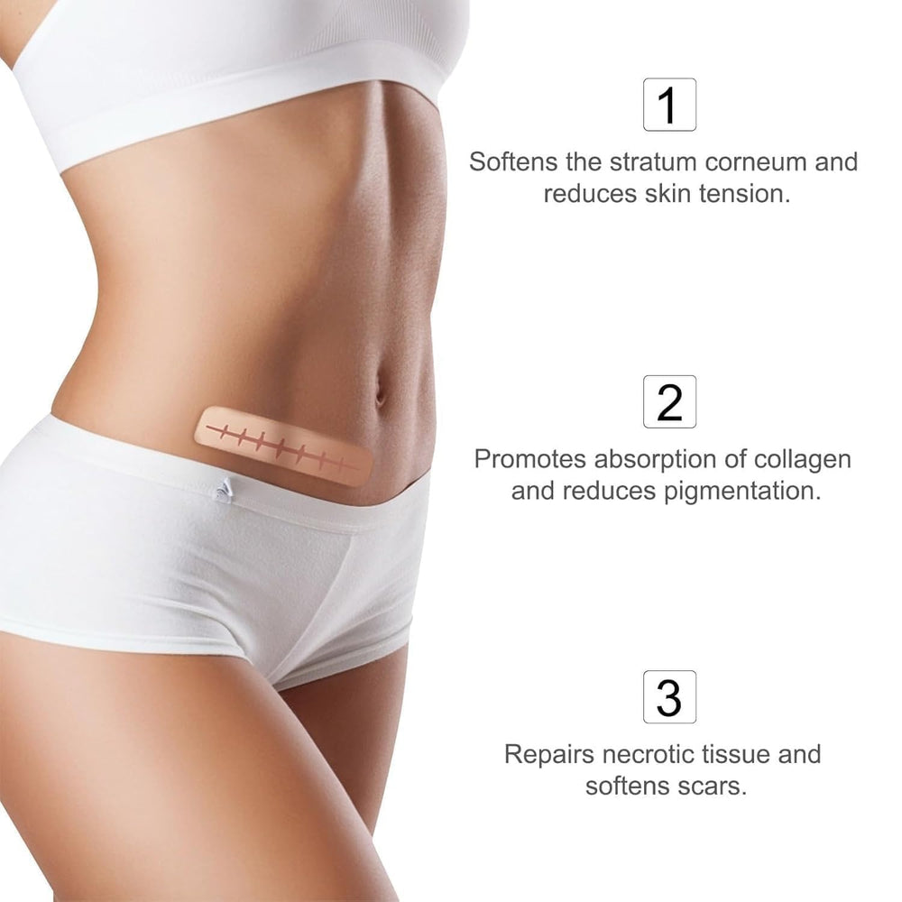 Silicone Scar Sheets,Silicone Scar Tape,Scar Tape For Surgical Scars,Silicone Scar Removal Strips For Surgical,C-Section,Tummy Tuck,Keloid Scars,Acne Scars, Reusable (1.6